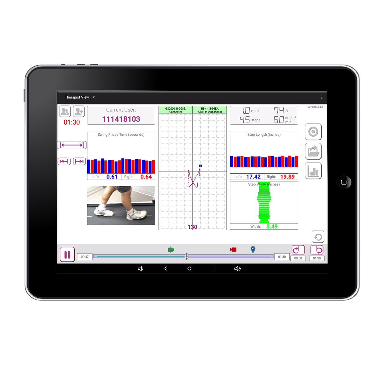 GaitKeeper Mini Therapy Treadmill With Gait Analysis